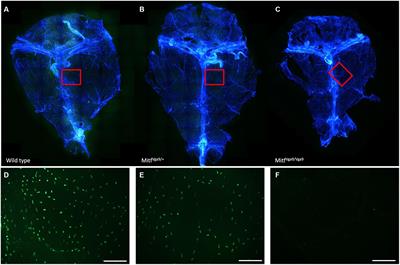 Absence of meningeal mast cells in the Mitf mutant mouse